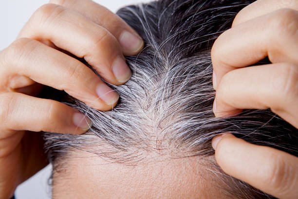 Cómo Combatir las Canas sin Dañar tu Cabello